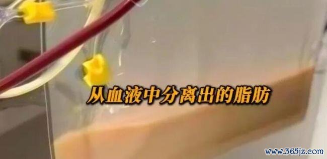 女子每天3杯奶茶 血液变乳白险丧命 奶茶醉心者需警惕